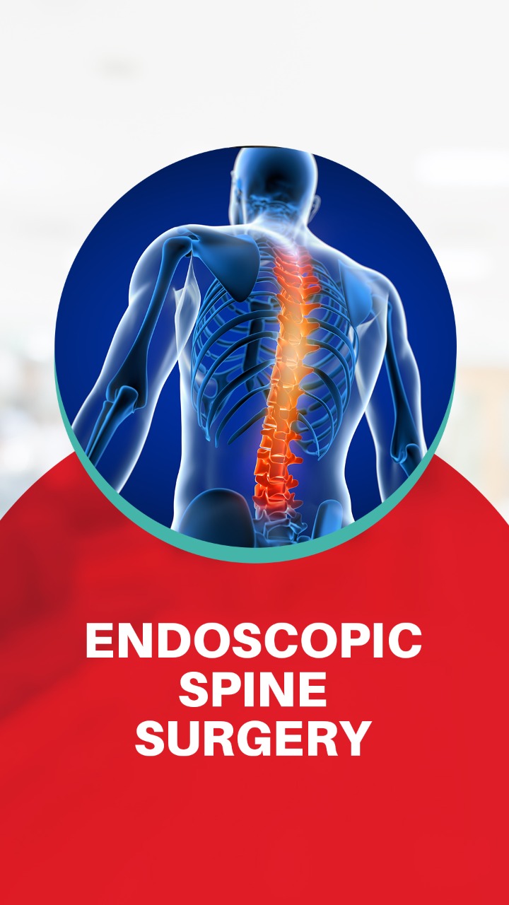 Endoscopic Spine Surgery