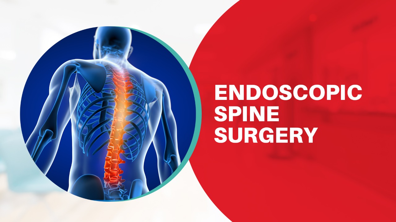 Endoscopic Spine Surgery