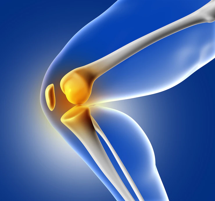 Joint Replacement